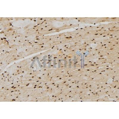 PSMB4 Antibody - DF7465 at 1/100 staining Rat heart tissue by IHC-P.