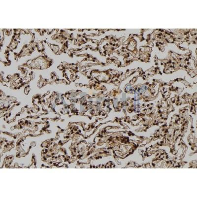 ROCK2 Antibody - DF7466 at 1/100 staining Human lung tissue by IHC-P.