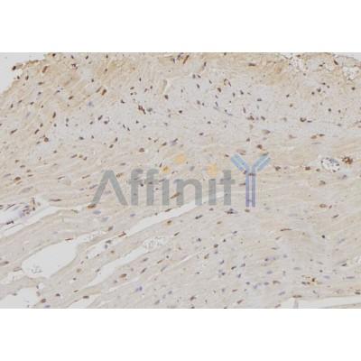 NOC4L Antibody - DF2218 at 1/100 staining Rat heart tissue by IHC-P.