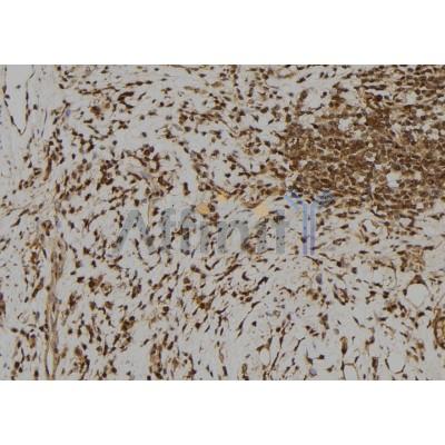 RFPL1 Antibody - DF2231 at 1/100 staining Human gastric tissue by IHC-P.