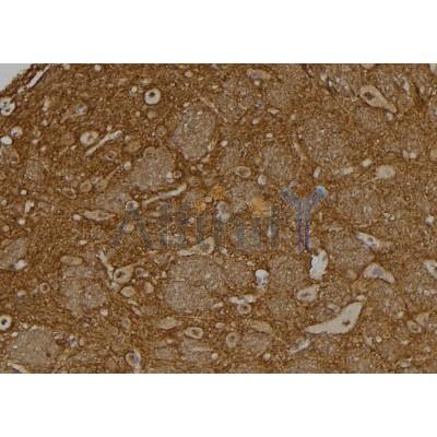 USP37 Antibody - DF2259 at 1/100 staining Rat brain tissue by IHC-P.