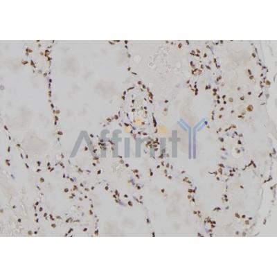 CENPL Antibody - DF2313 at 1/100 staining Human lung tissue by IHC-P.