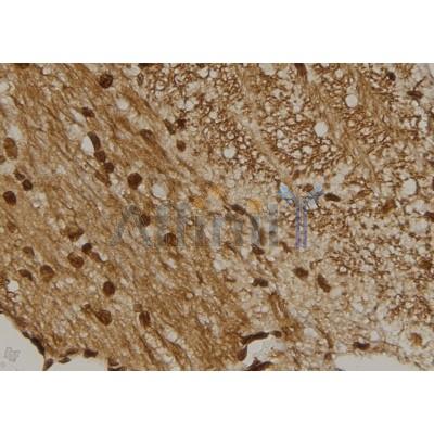 CENPM Antibody - DF2314 at 1/100 staining Mouse brain tissue by IHC-P.