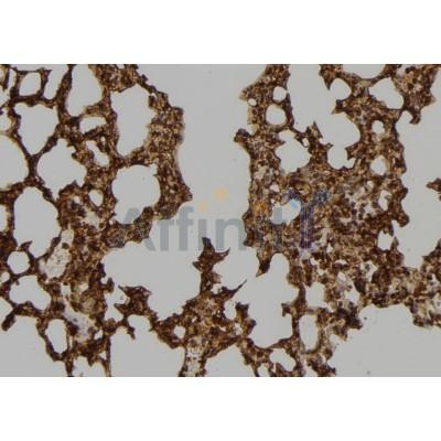 CENPT Antibody - DF2319 at 1/100 staining Mouse lung tissue by IHC-P.
