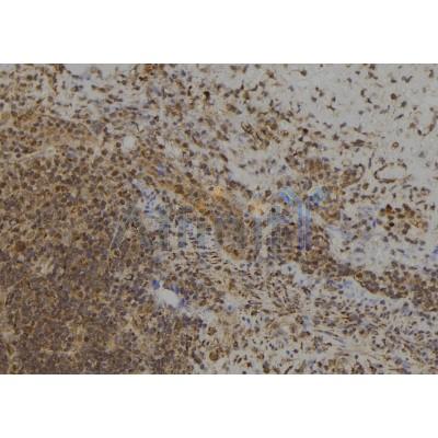 MAGD4 Antibody - DF2351 at 1/100 staining Human spleen tissue by IHC-P.