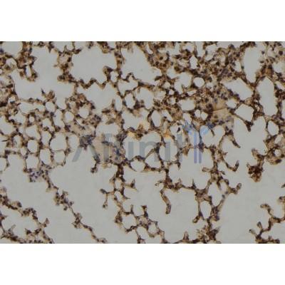 CA150 Antibody - DF2404 at 1/100 staining Mouse lung tissue by IHC-P.