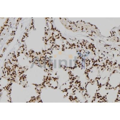 JHD3D Antibody - DF2411 at 1/100 staining Rat lung tissue by IHC-P.