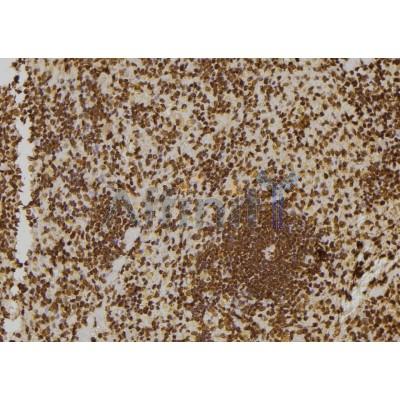 ZNF497 Antibody - DF2416 at 1/100 staining Rat spleen tissue by IHC-P.