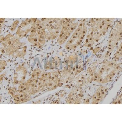 POGZ Antibody - DF2419 at 1/100 staining Human kidney tissue by IHC-P.
