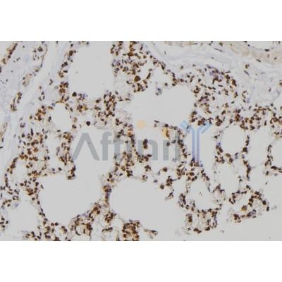 ZNF440 Antibody - DF2432 at 1/100 staining Rat lung tissue by IHC-P.