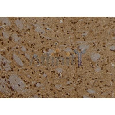 CPXCR1 Antibody - DF2435 at 1/100 staining Rat brain tissue by IHC-P.