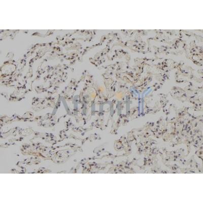 SNAPC3 Antibody - DF2440 at 1/100 staining Human lung tissue by IHC-P.