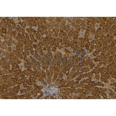 ARL11 Antibody - DF2443 at 1/100 staining Rat liver tissue by IHC-P.