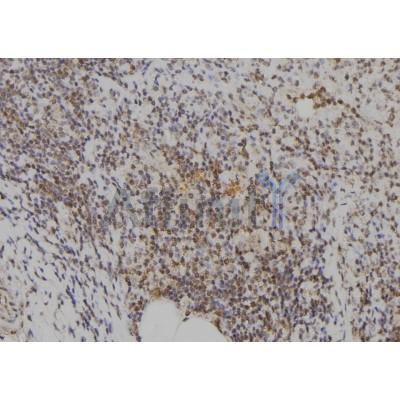 E2F7 Antibody - DF2444 at 1/100 staining Human spleen tissue by IHC-P.