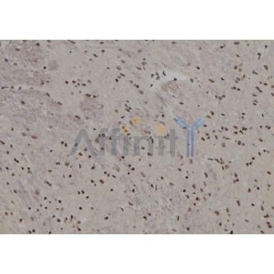 BACH2 Antibody - DF2461 at 1/100 staining Rat brain tissue by IHC-P.