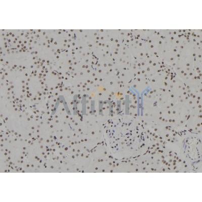 HSPB3 Antibody - DF2505 at 1/100 staining Rat kidney tissue by IHC-P.