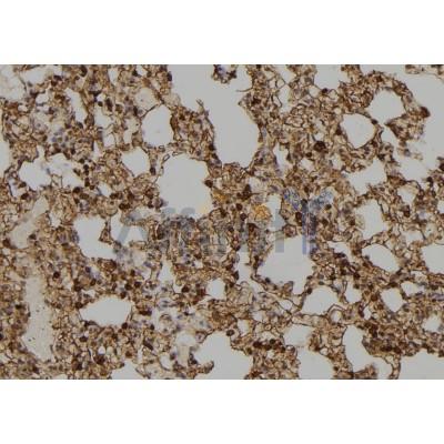 IN35 Antibody - DF2534 at 1/100 staining Rat lung tissue by IHC-P.