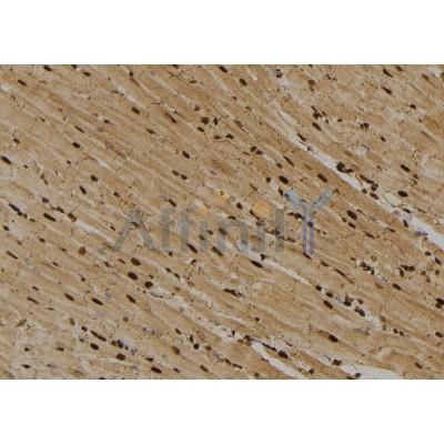 ITGA2 Antibody - DF2540 at 1/100 staining Rat heart tissue by IHC-P.