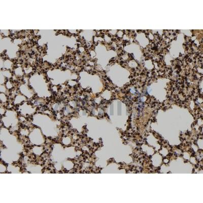 TUBD1 Antibody - DF2568 at 1/100 staining Mouse lung tissue by IHC-P.