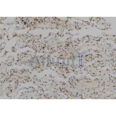 SYCP2 Antibody - DF2578 at 1/100 staining Human lung tissue by IHC-P.
