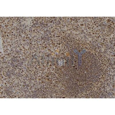 DYRK4 Antibody - DF2665 at 1/100 staining Mouse spleen tissue by IHC-P.