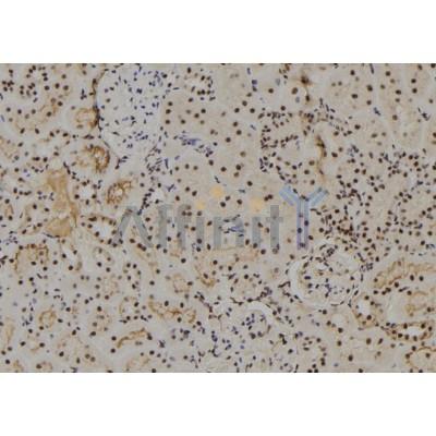 NUAK2 Antibody - DF2671 at 1/100 staining Rat kidney tissue by IHC-P.