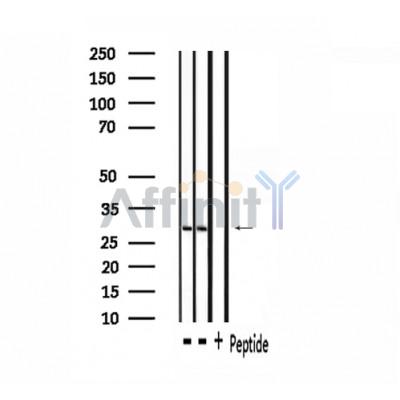SGK494 Antibody - Western blot analysis of extracts from rta brain, rat spleen , using SGK494 Antibody.