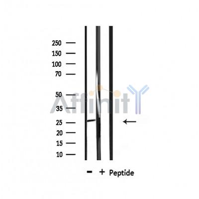 DDIT3/CHOP Antibody - Western blot analysis of extracts from mouse brain, using GADD153 Antibody.