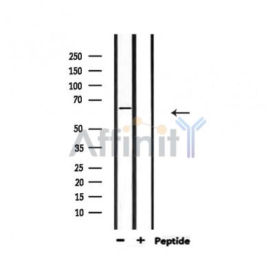 KITH_EBV Antibody - Western blot analysis of extracts from mouse lung, using KITH_EBV Antibody.