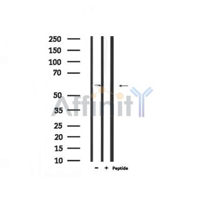Phospho-IFNAR1 (Ser535) Antibody - Western blot analysis of extracts from mouse lung, using IFNAR1 (Phospho-Ser535) Antibody.