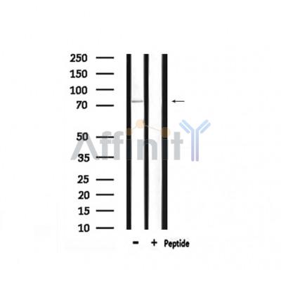 Phospho-PKC gamma (Thr514) Antibody - Western blot analysis of extracts from rat brain, using PKC γ (Phospho-Thr514) Antibody.