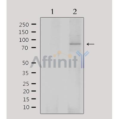 SATB1 Antibody - Western blot analysis of extracts from mouse brain, using SATB1 Antibody.