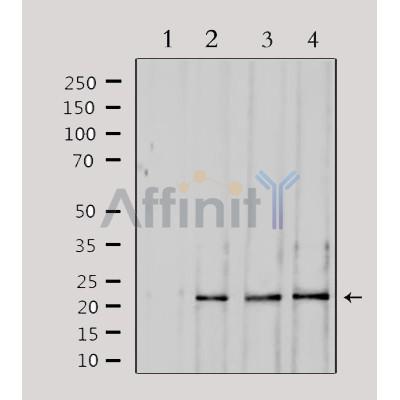 SOCS2 Antibody - Western blot analysis of extracts from various samples, using SOCS2 Antibody.