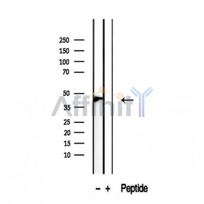 Podoplanin Antibody - Western blot analysis of extracts from HEK-293 cells, using Podoplanin antibody.