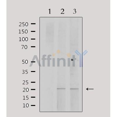 PPP1R14C Antibody - Western blot analysis of extracts from various samples, using PPP1R14C Antibody.