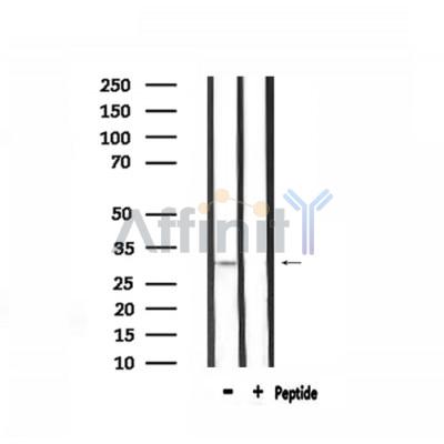 CNN2 Antibody - Western blot analysis of extracts from mouse brain, using CNN2 Antibody.