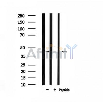 CMKLR1 Antibody - Western blot analysis of extracts from mouse brain, using CMKLR1 Antibody.