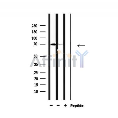 NXF1 Antibody - Western blot analysis of extracts from 293 and mouse brain, using NXF1 Antibody.