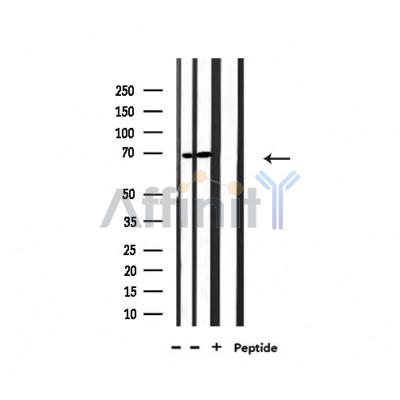 NXF1 Antibody - Western blot analysis of extracts from 293 and Hela, using NXF1 Antibody.
