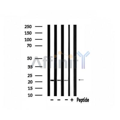 MRPL11 Antibody - Western blot analysis of extracts from 293 and hela and rat brain, using MRPL11 Antibody.