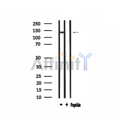ADAMTS19 Antibody - Western blot analysis of extracts from Hela, using ADAMTS19 Antibody.