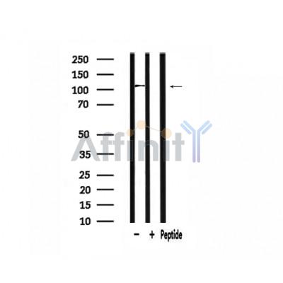 ATXN2L Antibody - Western blot analysis of extracts from 293, using ATXN2L Antibody.
