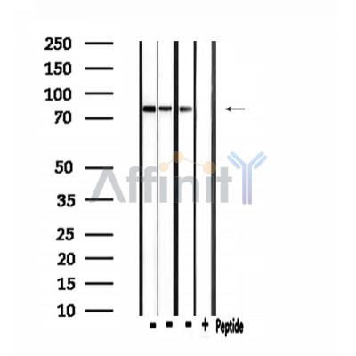 CLCN4 Antibody - Western blot analysis of extracts from mouse brain and 293 and mouse lung, using CLCN4 Antibody.