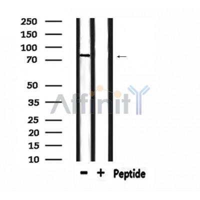 LRRC41 Antibody - Western blot analysis of extracts from mouse brain, using LRRC41 Antibody.