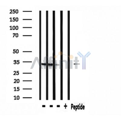 RAB40B Antibody - Western blot analysis of extracts from mouse spleen, rat spleen and Hela, using RAB40B Antibody.