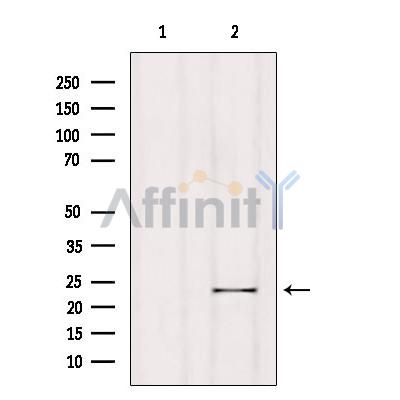 RGS1 Antibody - Western blot analysis of extracts from Hela, using RGS1 Antibody.