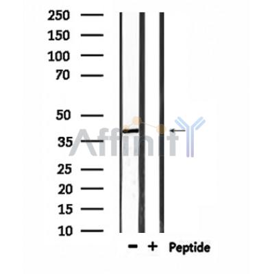 RRS1 Antibody - Western blot analysis of extracts from HepG2, using RRS1 Antibody.