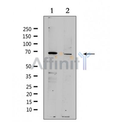ZP4 Antibody - Western blot analysis of extracts from various samples, using ZP4 Antibody.