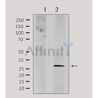 NDFIP1 Antibody - Western blot analysis of extracts from HepG2, using NDFIP1 Antibody.