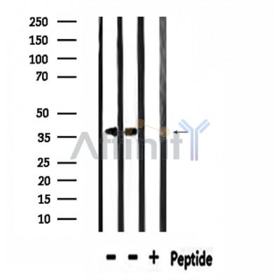 SPON2 Antibody - Western blot analysis of extracts from 293 and mouse brain, using SPON2 Antibody.